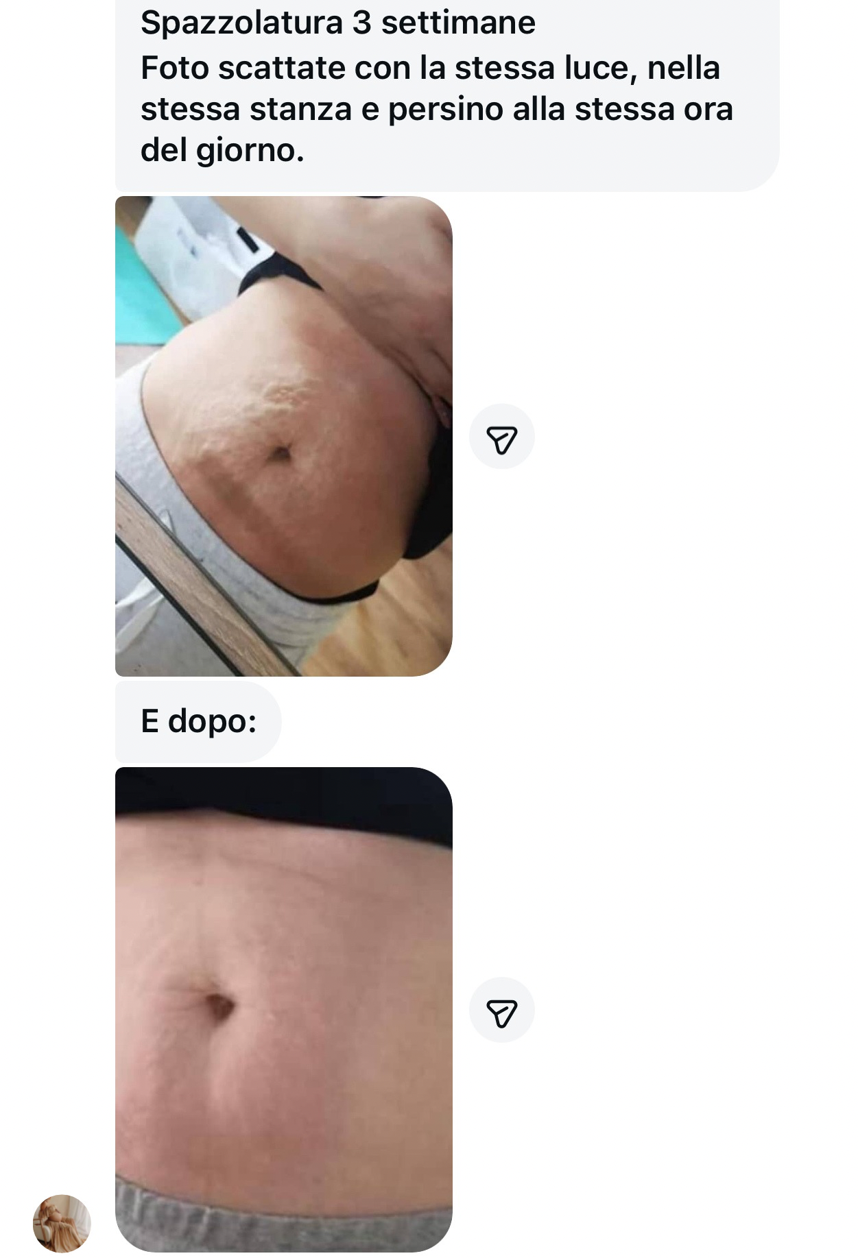 Spazzola per Massaggio a Secco