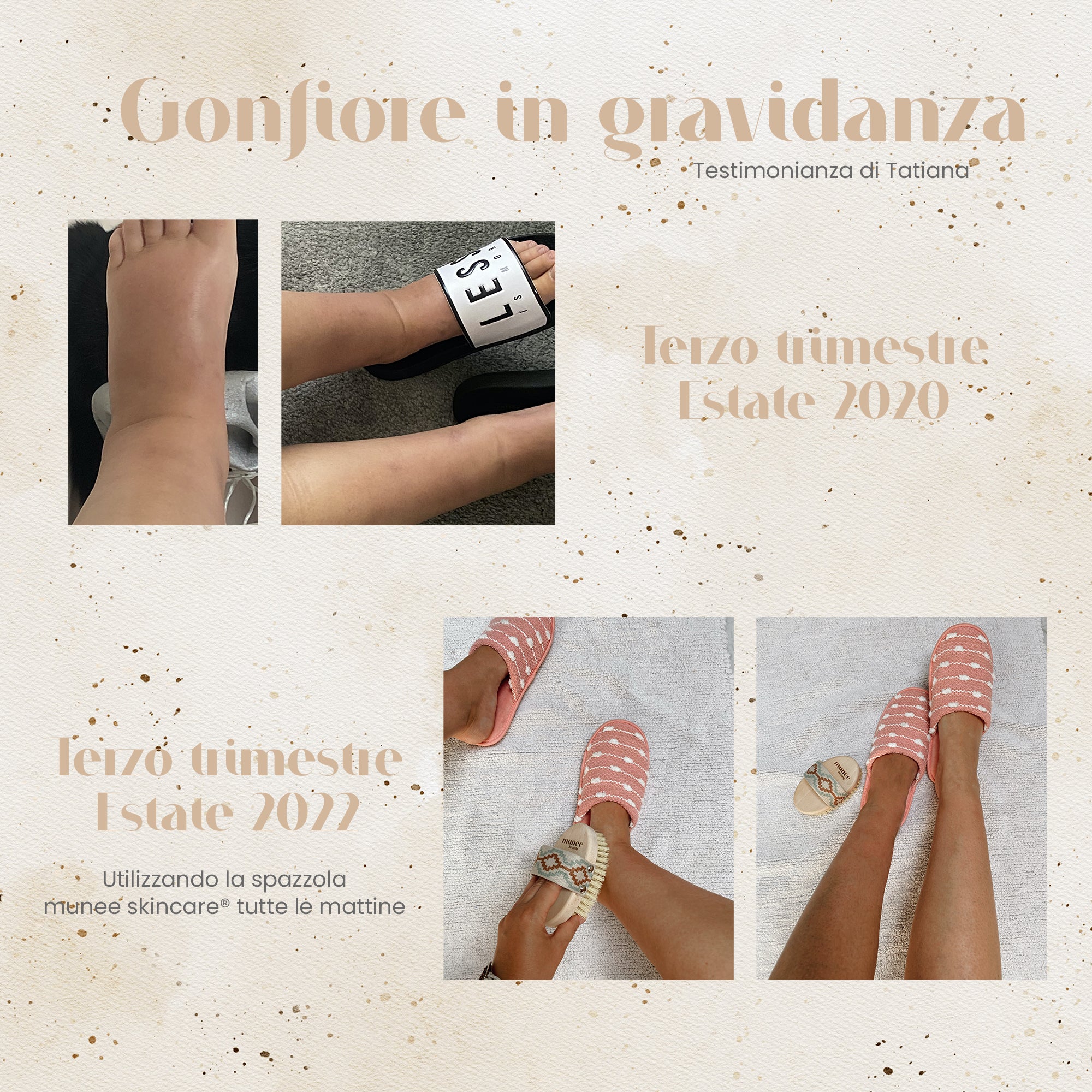 Spazzola per Massaggio a Secco